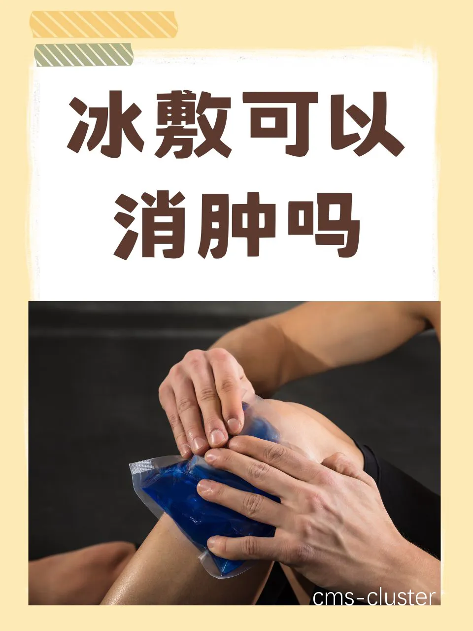 冰敷治疗示例