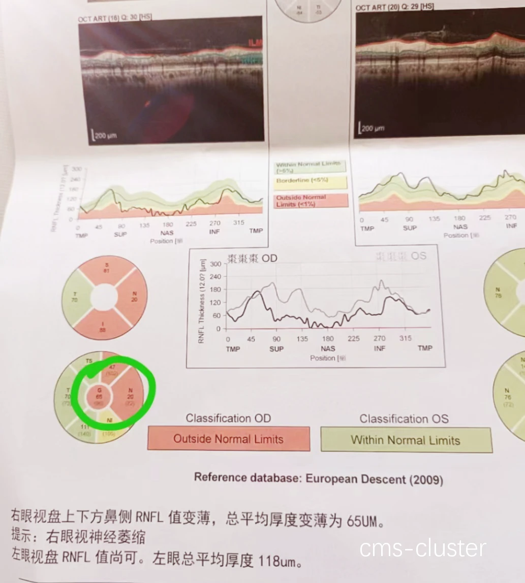 心理状态监测曲线图