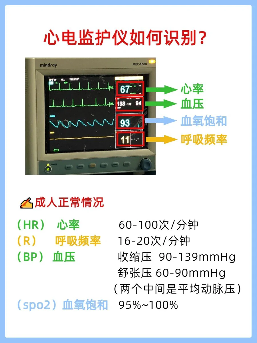 心率监测示意图